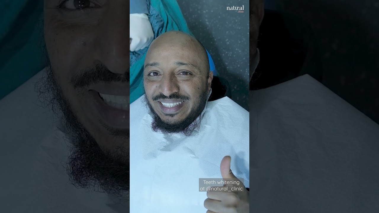 teeth whitening at Natural Clinic #turkey #teethwhitening #teeth #dentist #fyp