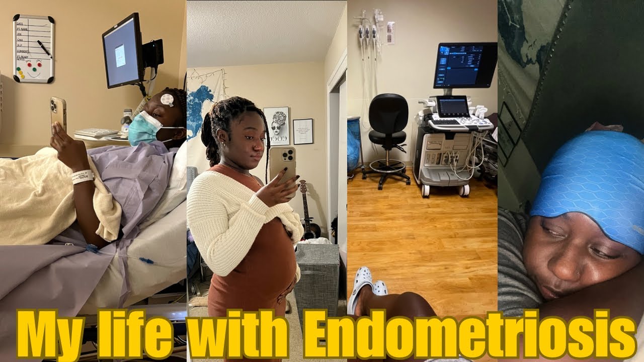 My Endometriosis story🎗️