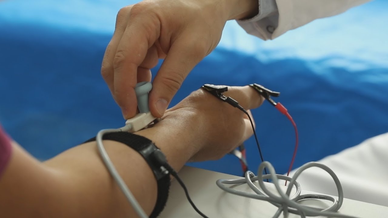 Стимуляционная электронейромиография