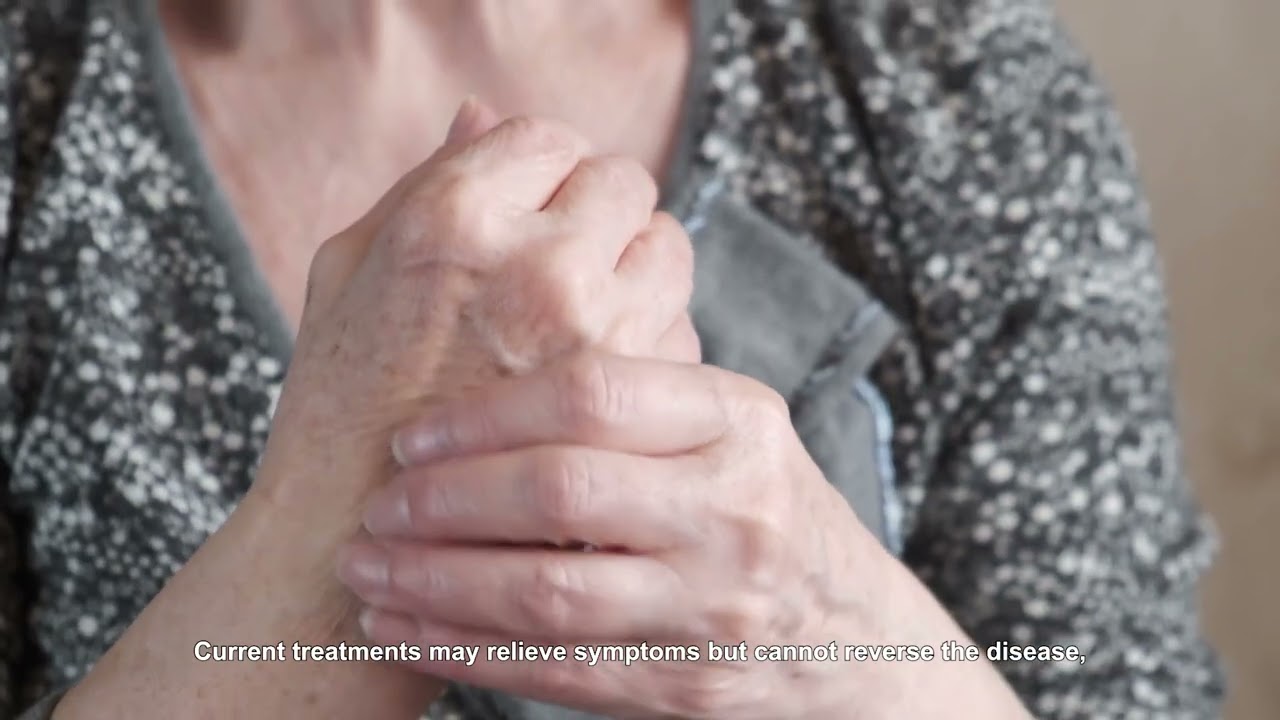 A Transformative Approach for Myleofibrosis
