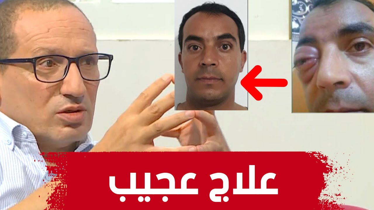 الحالة المرضية التي  استعصت على أغلب مستشفيات الجزائر.. شاهدوا ماهي و كيف عالجها البروفيسور زروال