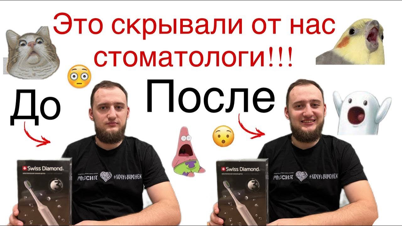 Это скрывали от нас стоматологи!!! Вы будете в шоке от увиденного😯😲