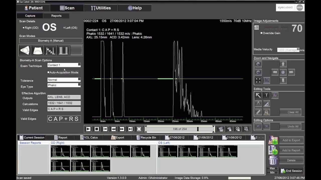 Performing Contact Biometry with the Ellex Eye Cubed