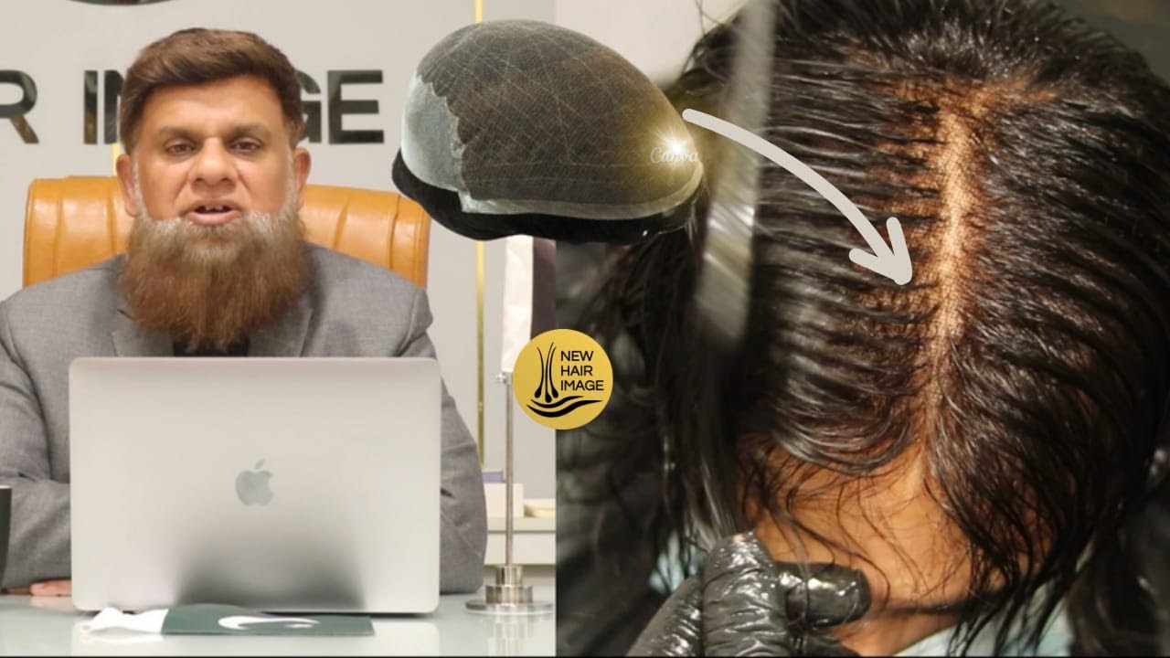 ULTRA THIN Q6 HAIR SYSTEM: The Truth Behind Fake vs Natural Hair Patches