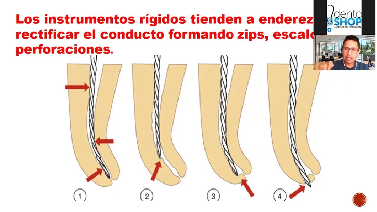 TALLER VIRTUAL: CINEMATICA RECIPROCANTE EN ENDODONCIA
