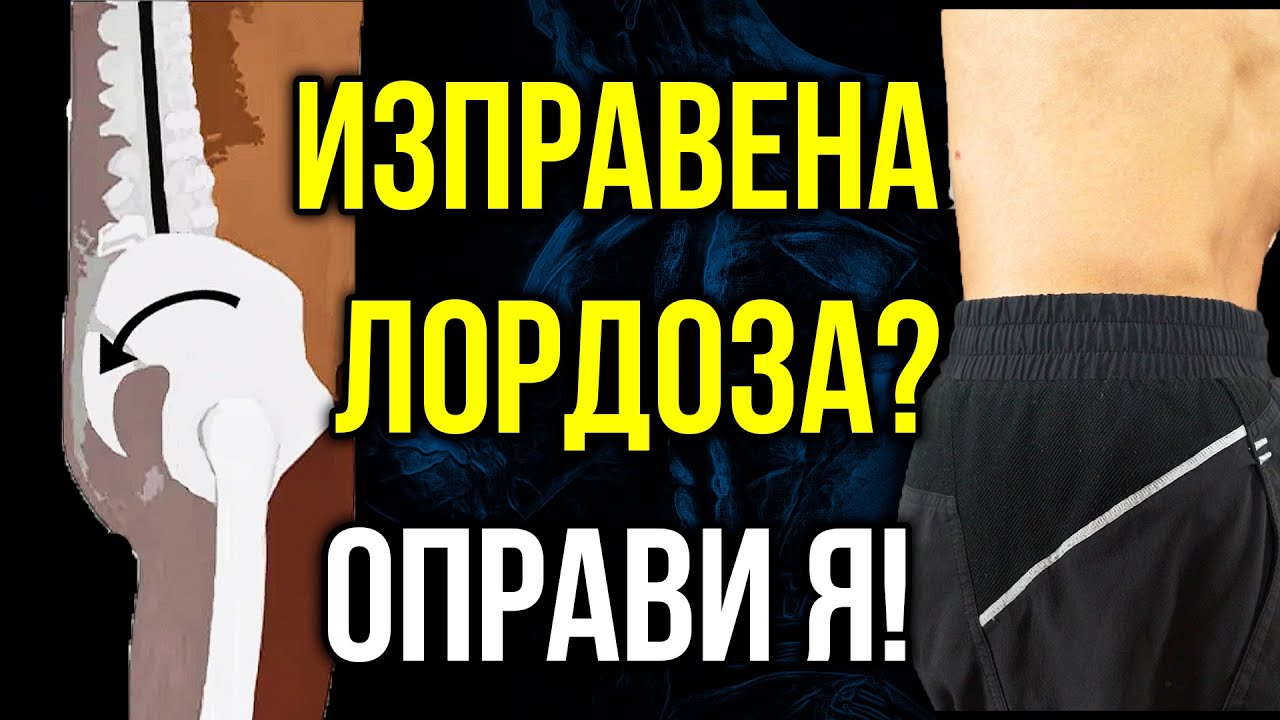 Изправена ЛОРДОЗА? - 5 упражнения за ИЗГЛАДЕНА ЛОРДОЗА