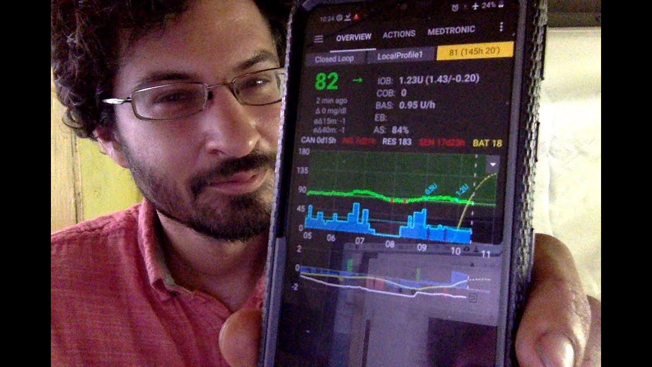 Intro Guide to Looping with AndroidAPS