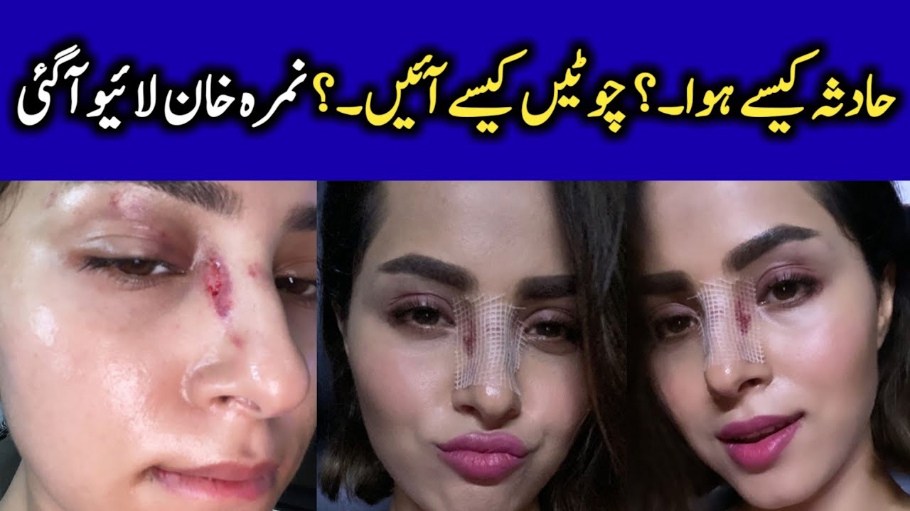 Nimra Khan Telling How Her Accident Happened | CT1