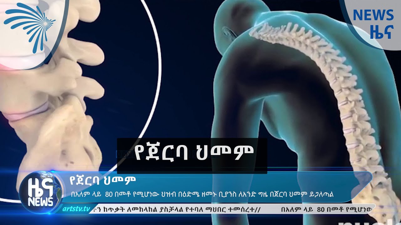 የጀርባ ህመም- News [Arts TV World]