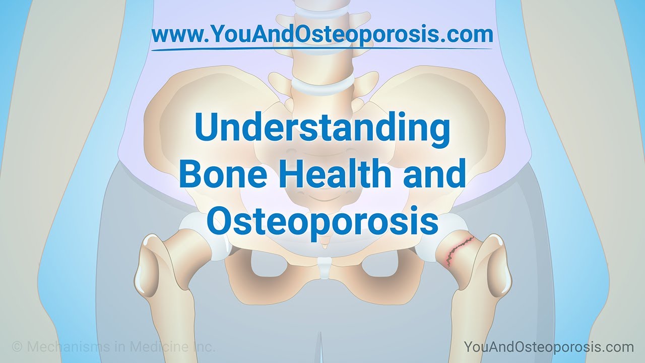 Understanding Bone Health and Osteoporosis