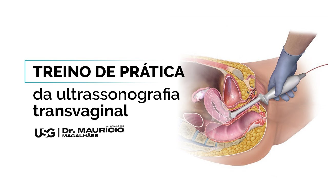 Treino de prática da ultrassonografia Transvaginal