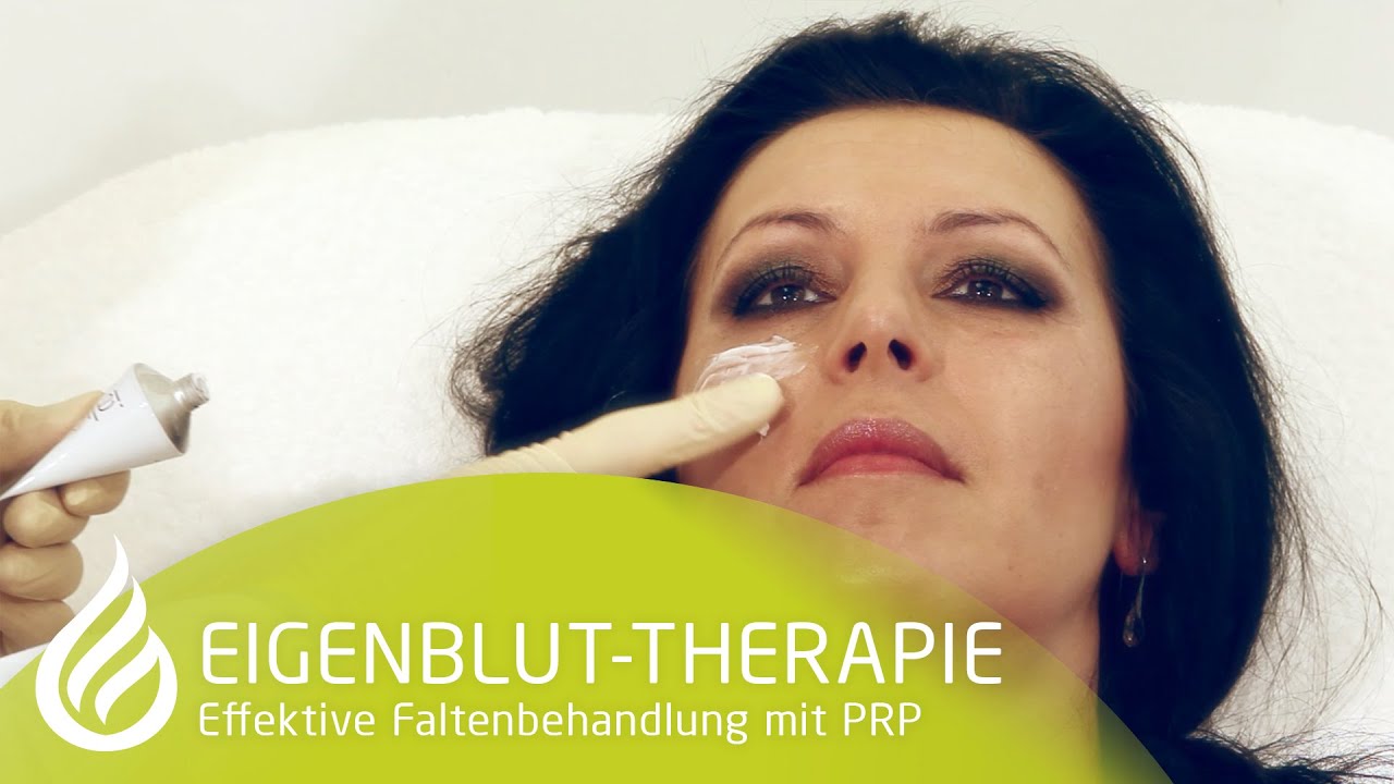 PRP Faltenbehandlung mit Eigenblut