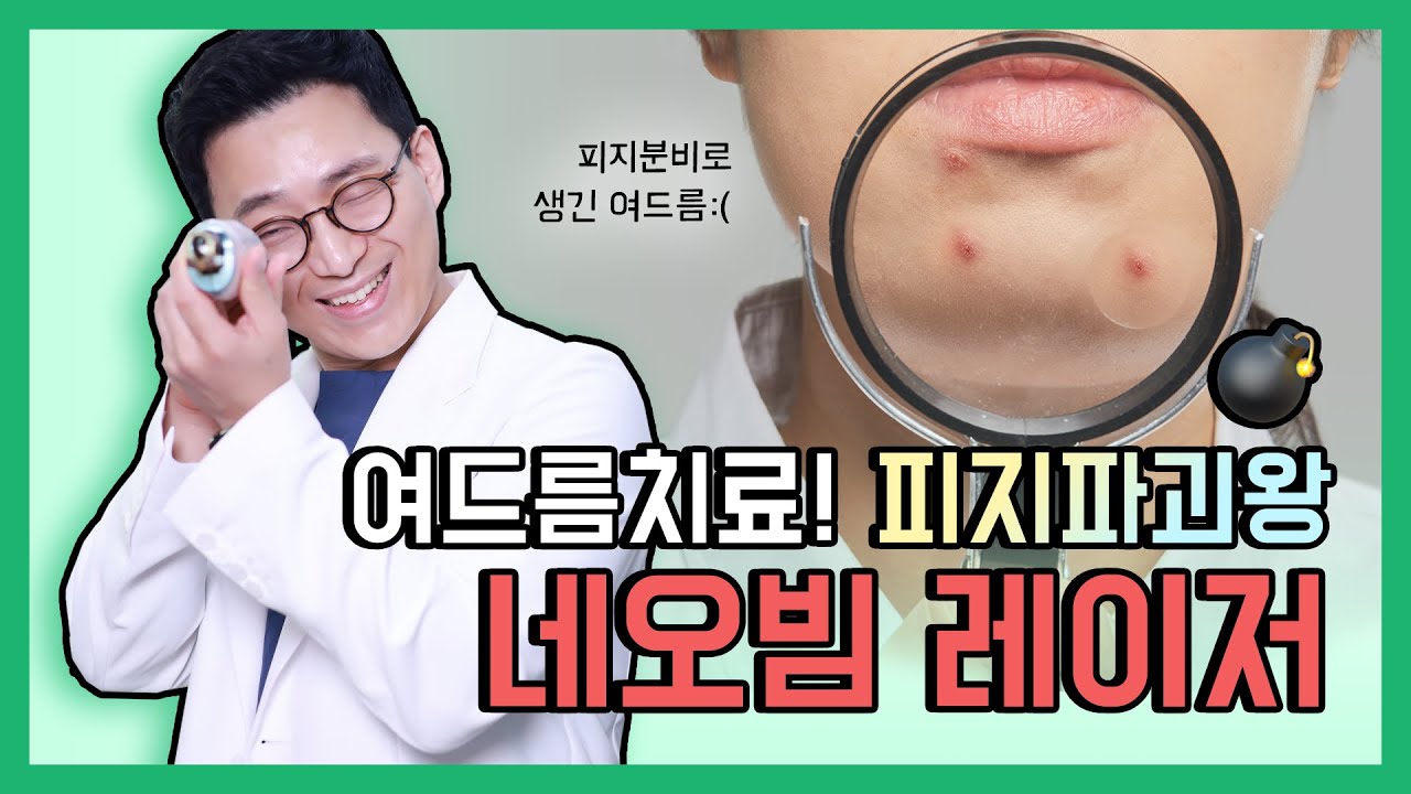 피지부터 여드름 치료까지, 네오빔으로 해결!!