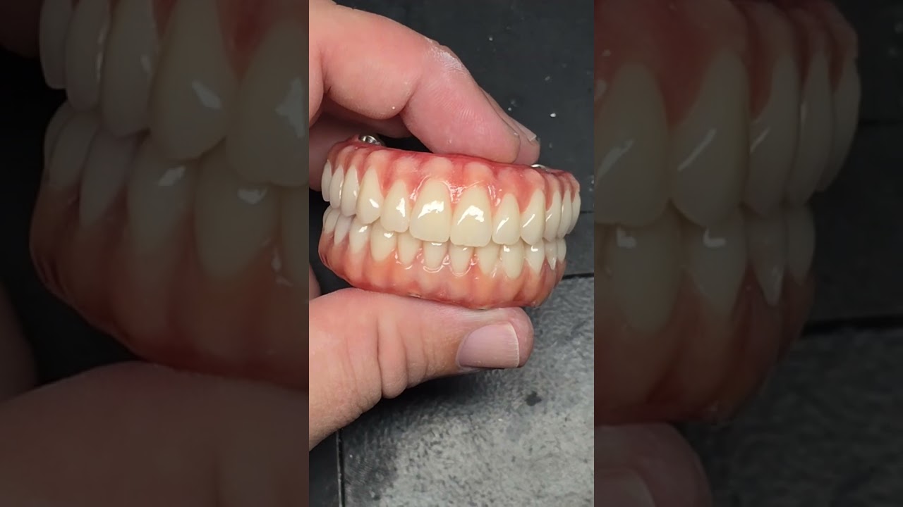 Protocolo duplo em resina # #protocolos #dentadura
