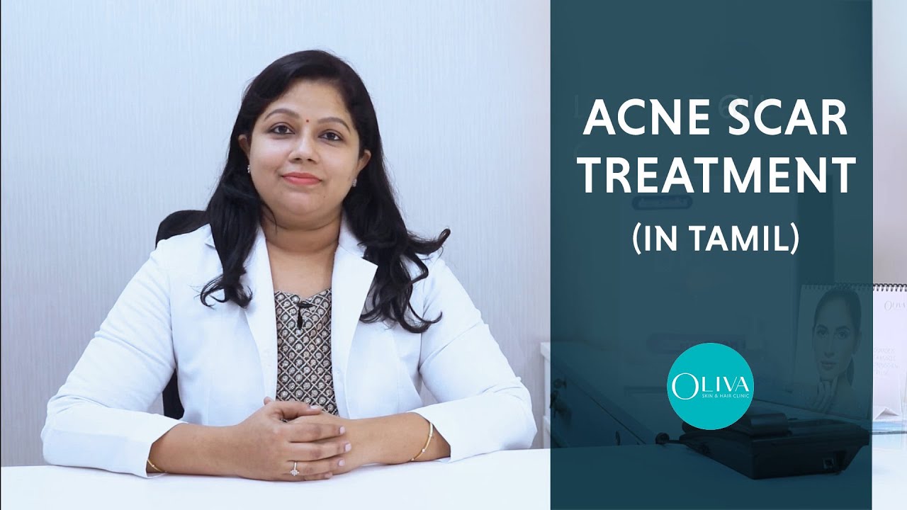 Best Treatment For Acne Scars And Pimple Marks (Tamil) - முகபரு வடு விடுபட
