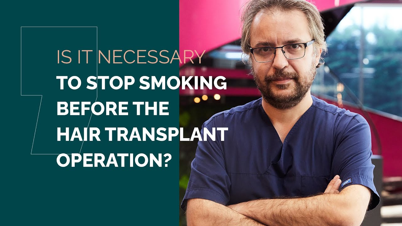 Is It Necessary to Stop Smoking Before the Hair Transplant Operation?