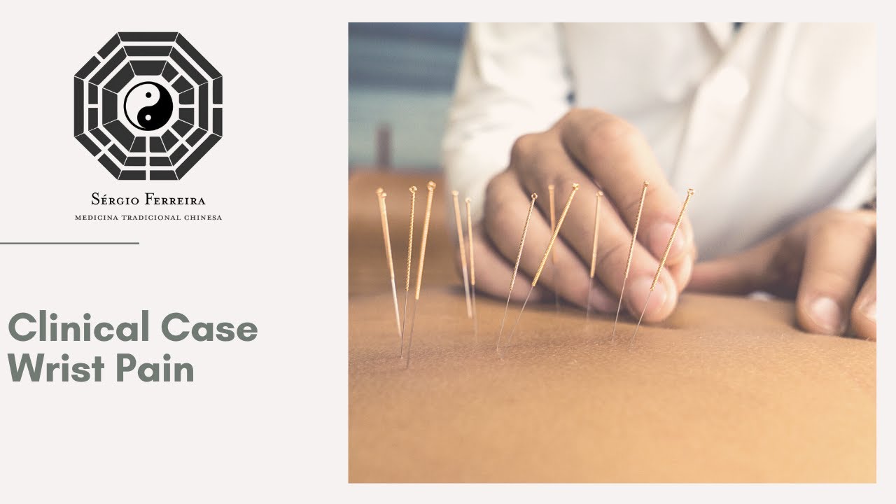 Treating Wrist Pain Using Acupuncture with Instant Results