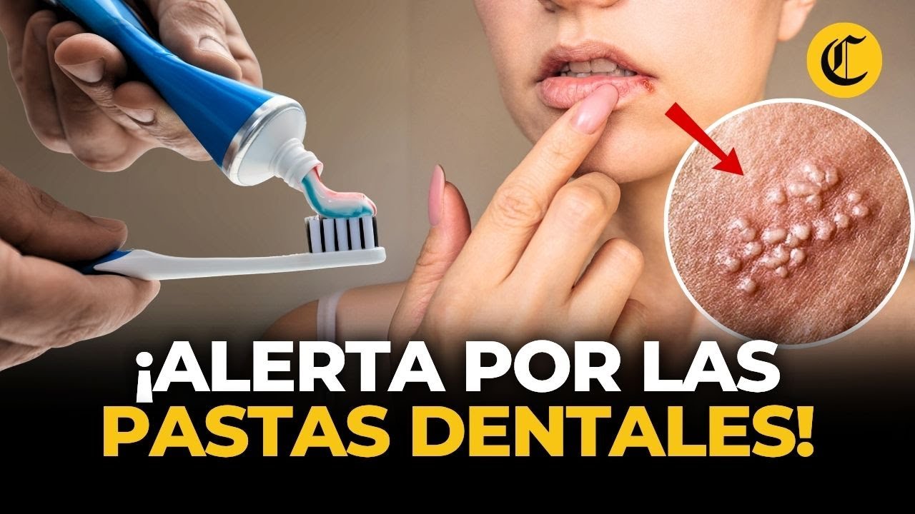 DIGEMID alerta sobre efectos adversos de pastas dentales: &uacute;lceras y otros problemas | El Comercio