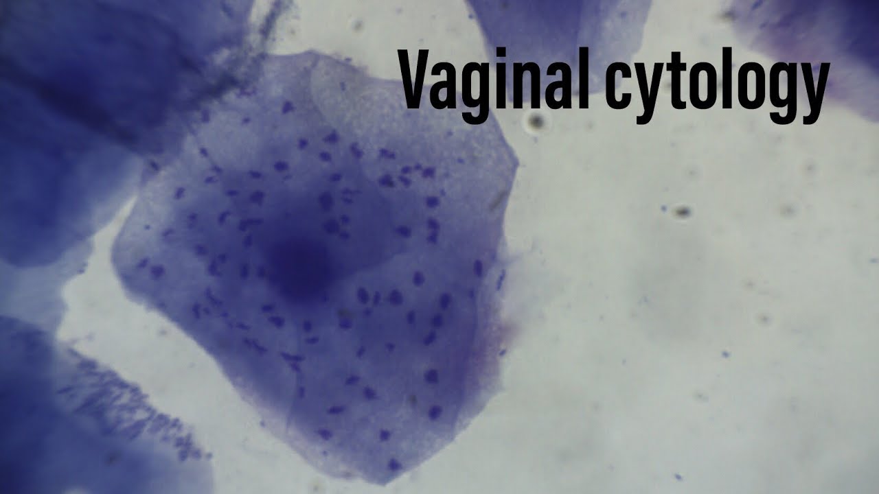 Vaginal cytology interpretation- canine estrus cycle