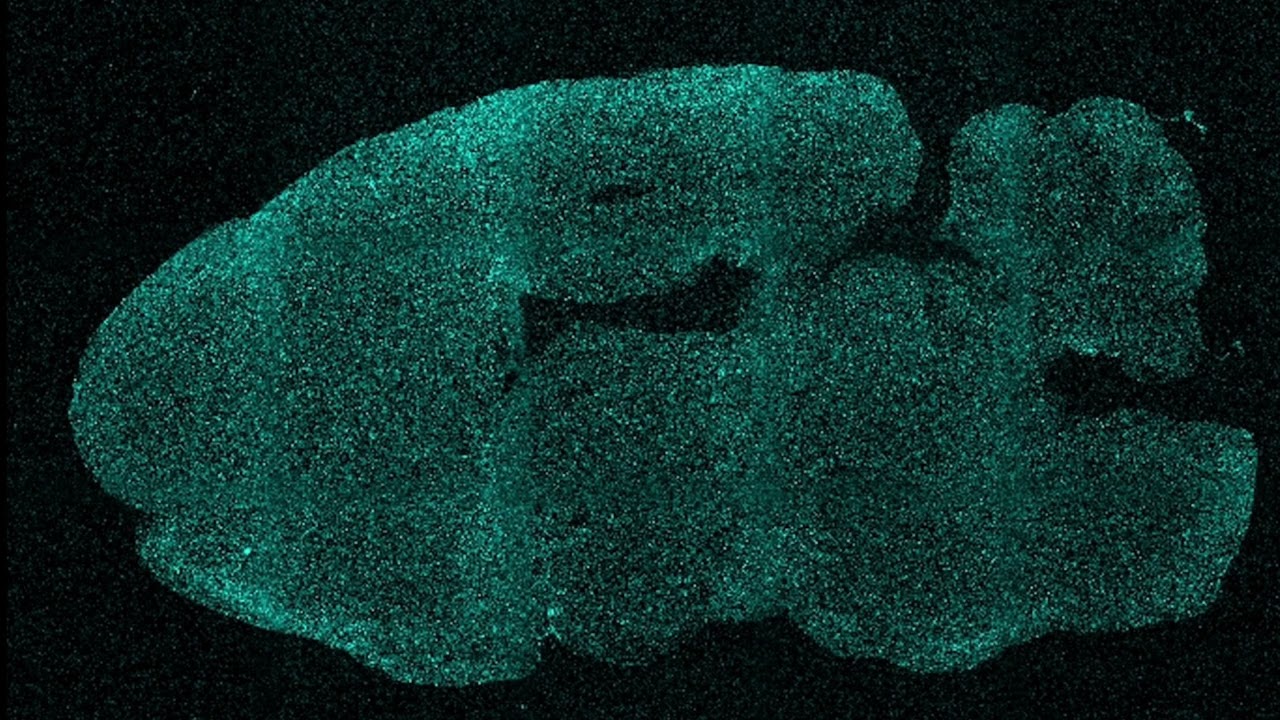 Sinai Health: Near-infrared Imaging at the Network Biology Collaborative Centre