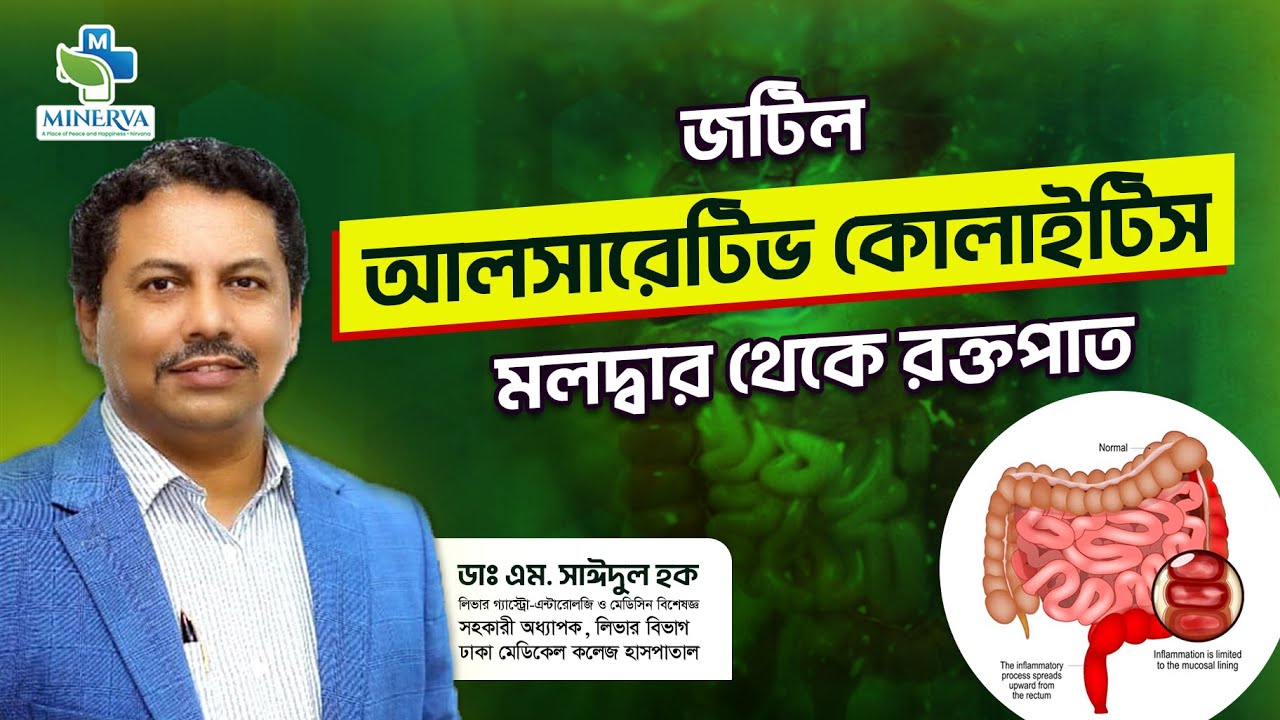 জটিল আলসারেটিভ কোলাইটিস মলদ্বার থেকে রক্তপাত/ Minerva Hospital Ltd.