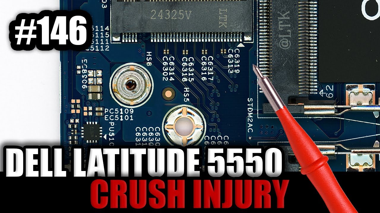 DELL LATITUDE 5550 - CRUSH INJURY!
