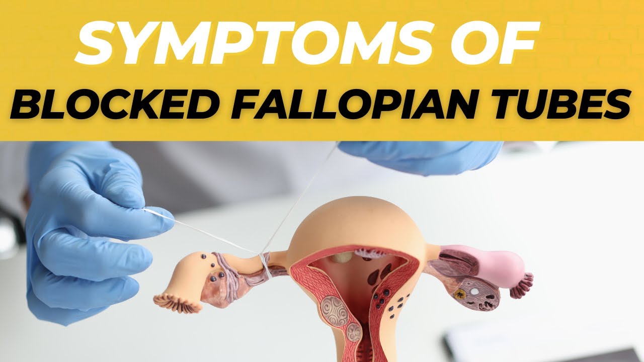 Symptoms of Blocked Fallopian Tubes And Treatment Options