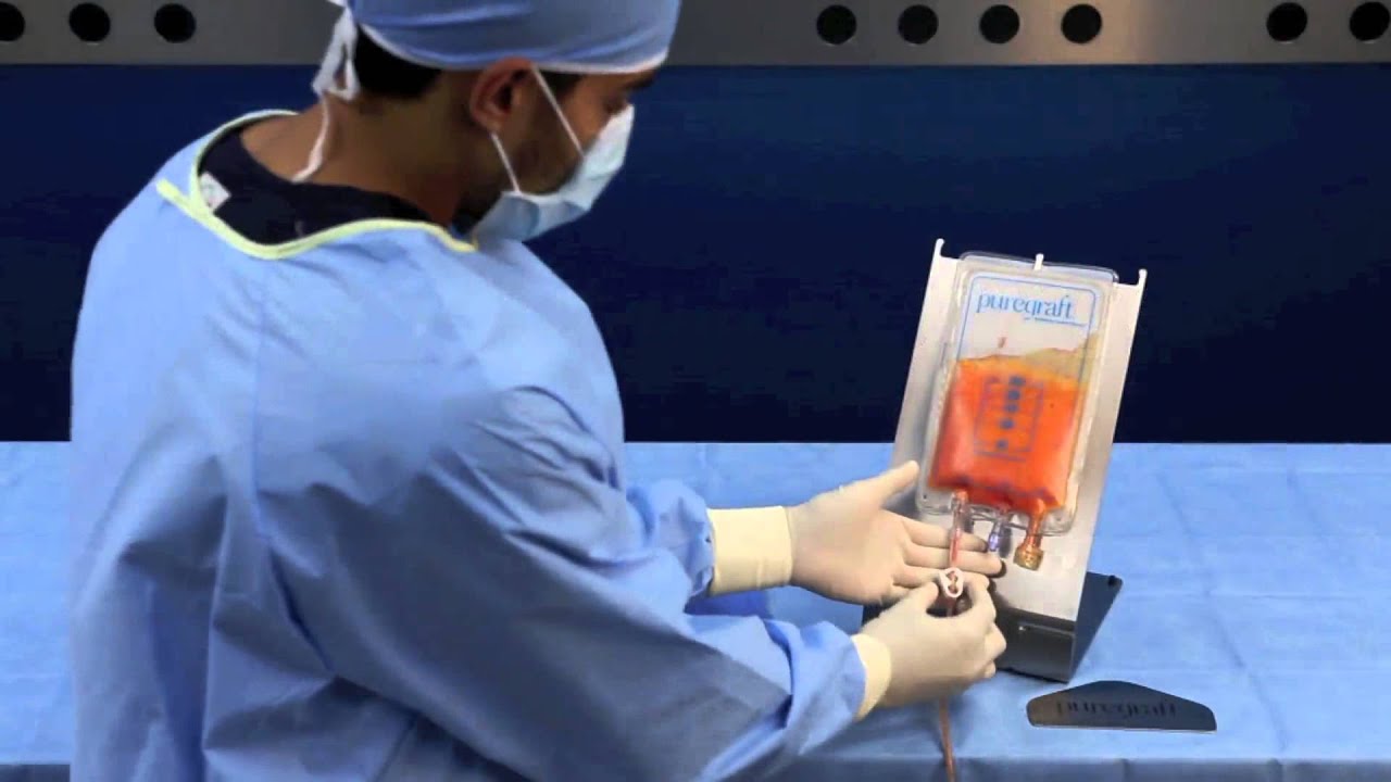 Puregraft 250 Training Video