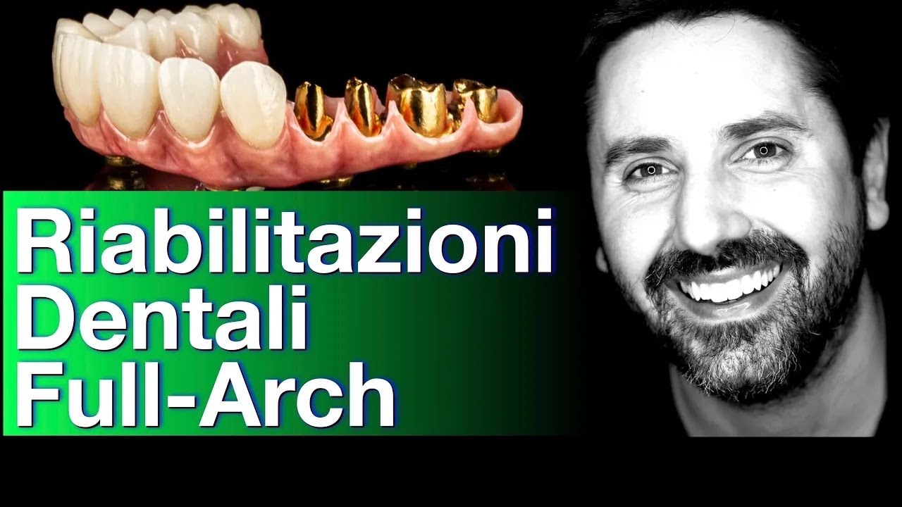 Riabilitazioni dentali Full Arch estreme: La Bocca bionica | Dr Palmas Il Film