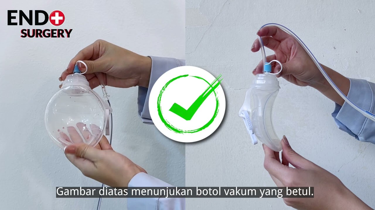 SISTEM SALIRAN LUKA TERTUTUP- PANDUAN PESAKIT