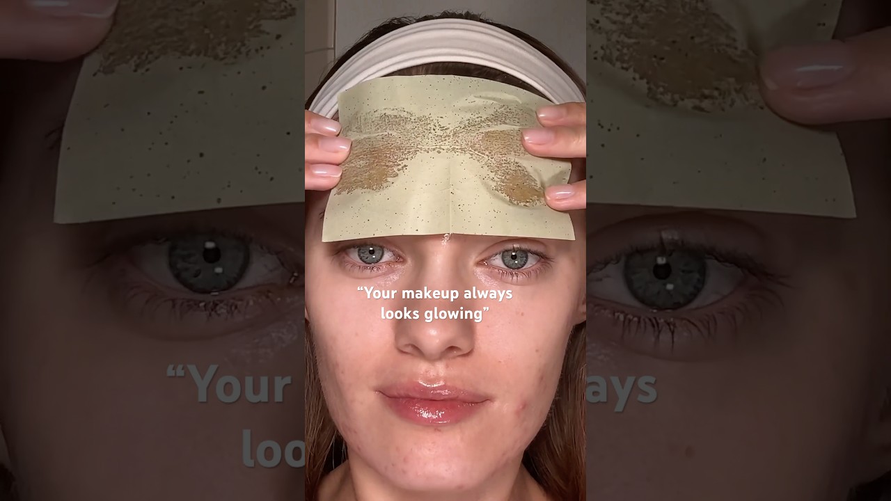 Oily skin benefits✨💖 but at this point is Acne worth it?🥹🥲 #acne #skincareroutine #acnetreatment