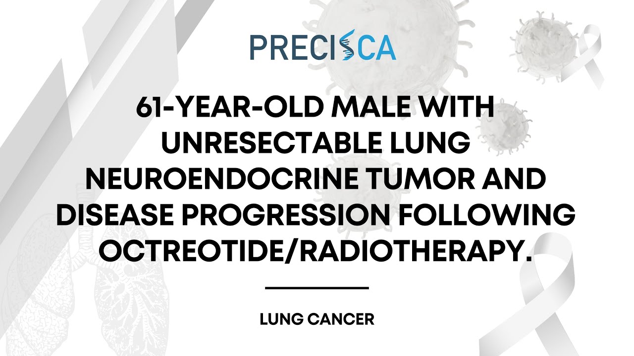 Expert Cancer Panel: Unresectable lung neuroendocrine tumor with progression after octreotide and RT