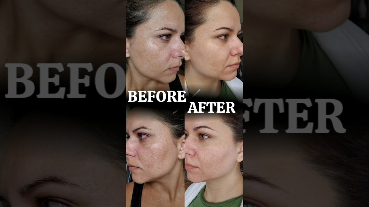 SPA TREATMENT @ home w/Atomy Evening Care Set |Deep Cleanser+Foam Cleanser+Peeling Gel+Peel Off Mask