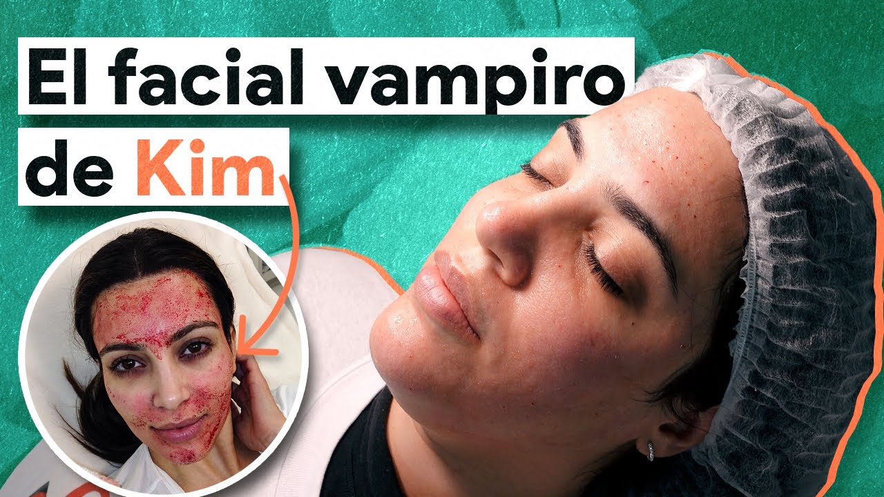 PLASMA RICO EN PLAQUETAS! Qué es, cómo funciona y antes y depués.