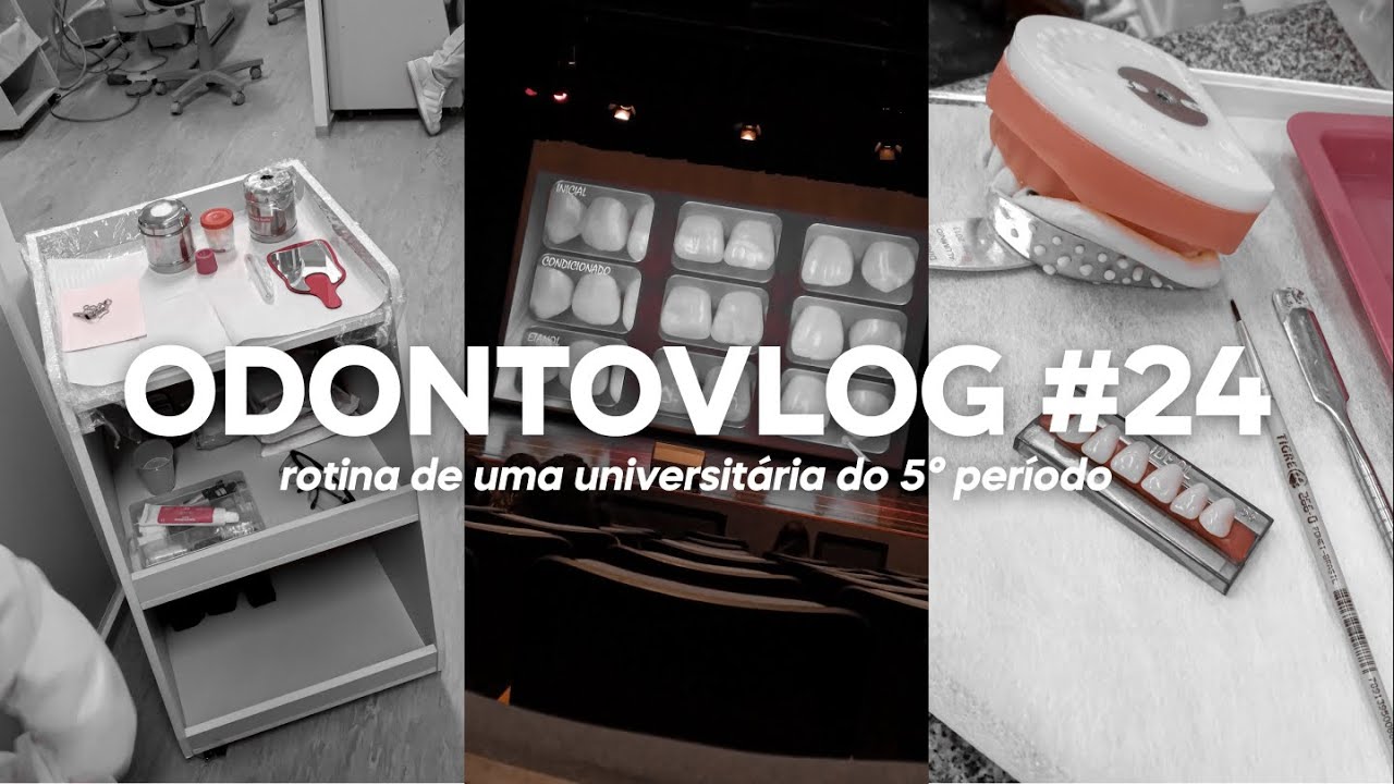 ODONTOVLOG #24: primeira cl&iacute;nica, JOU, lab de pr&oacute;tese e brindes :) | Odonto Energy
