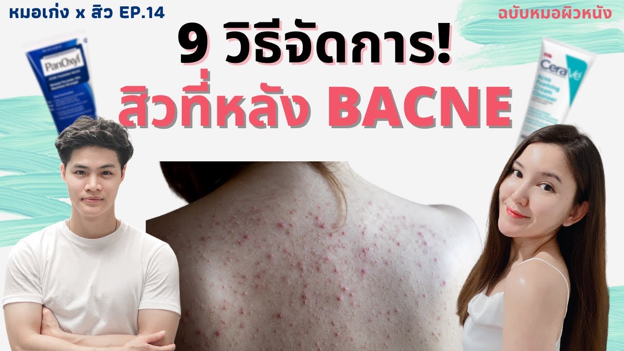 9 วิธีรักษา #สิวที่หลัง Bacne EP. 14 | Drkengw หมอเก่ง หมอผิวหนัง