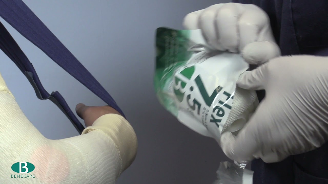 Above Elbow Cast