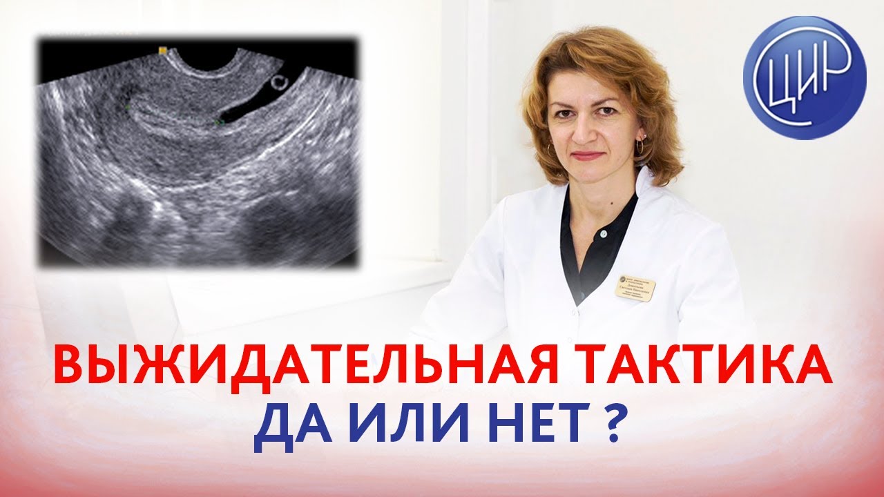 Выжидательная тактика при многоплодной замершей беременности. Да или нет? Дементьева С.Н.