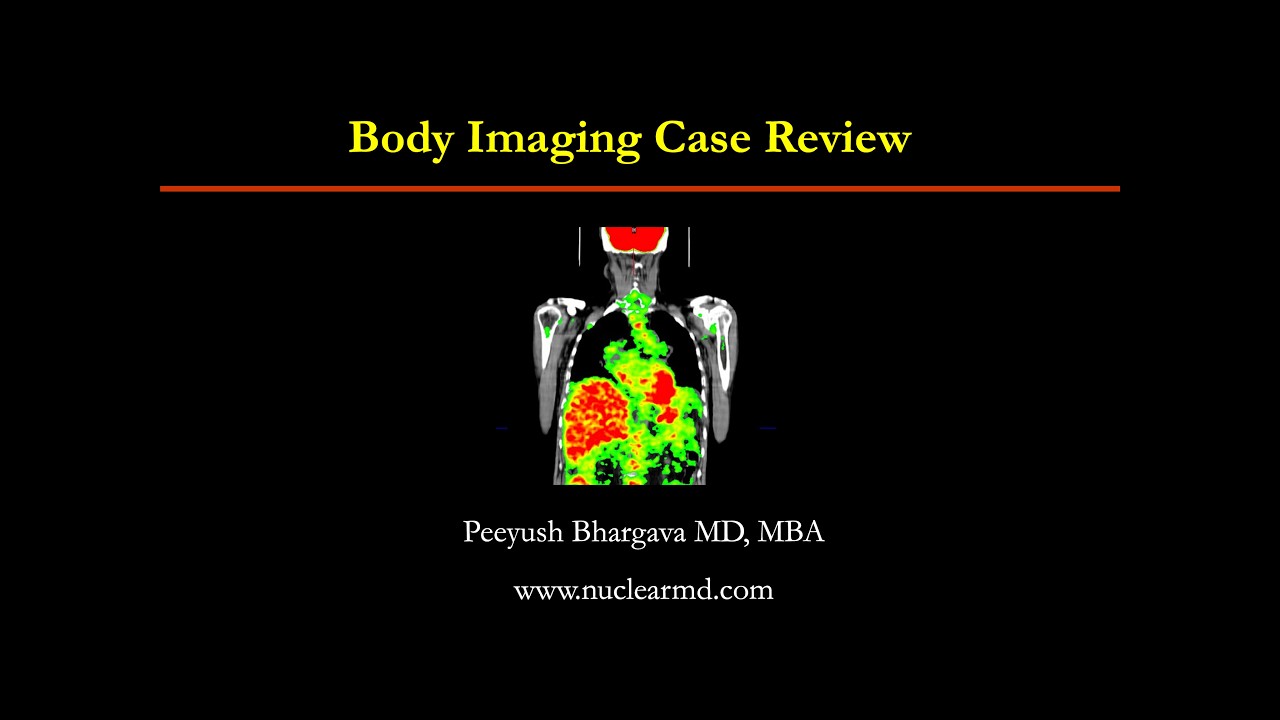 Body Imaging # 22