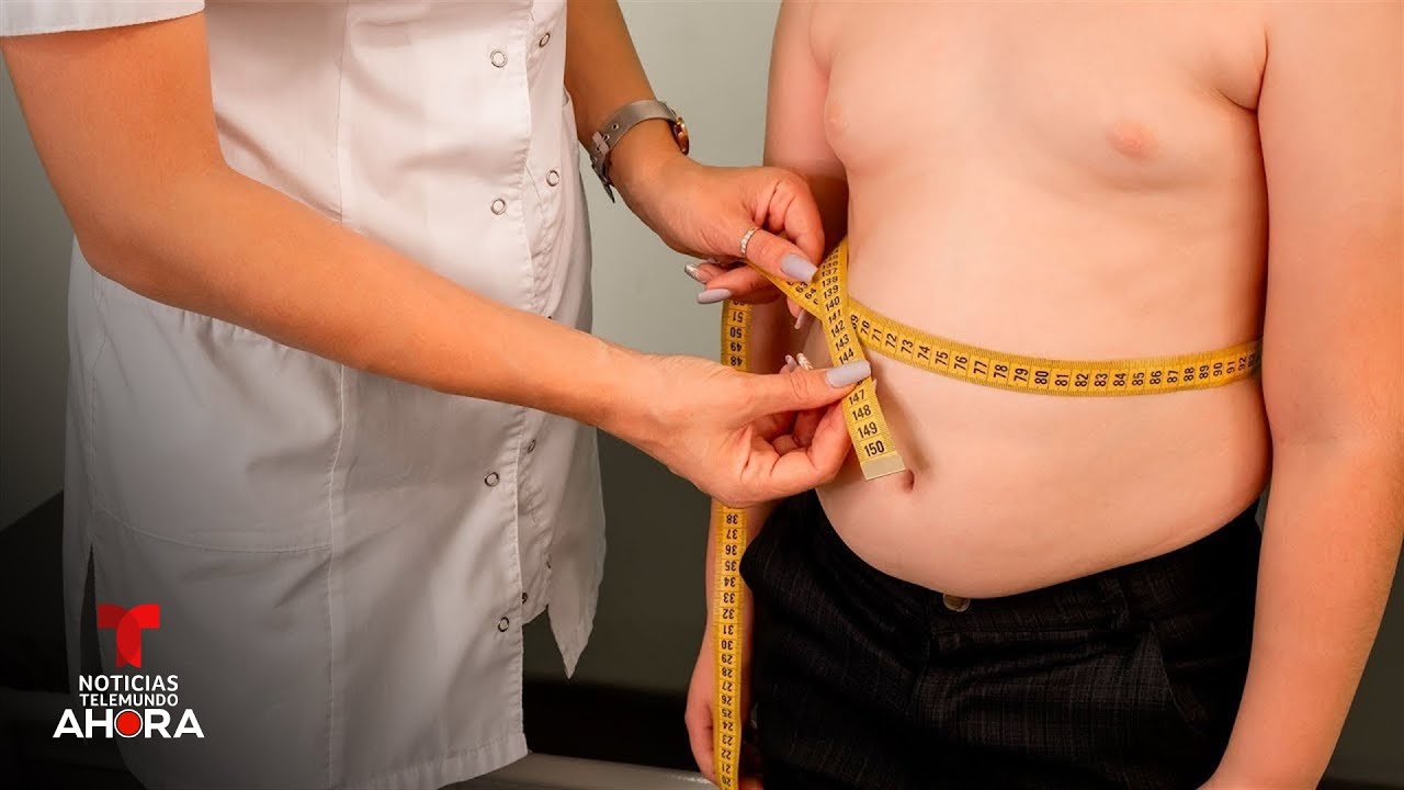 Los los CDC revelan que EE.UU. tiene la tasa de obesidad infantil más alta en 50 años
