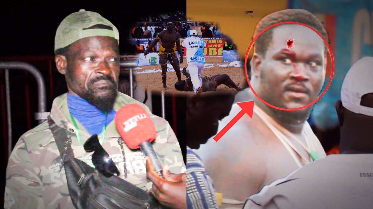 Ndeysan fils de balla gravement blessé Assane Ron totie na Kass yi li khew Guediawaye balla Gaye ..