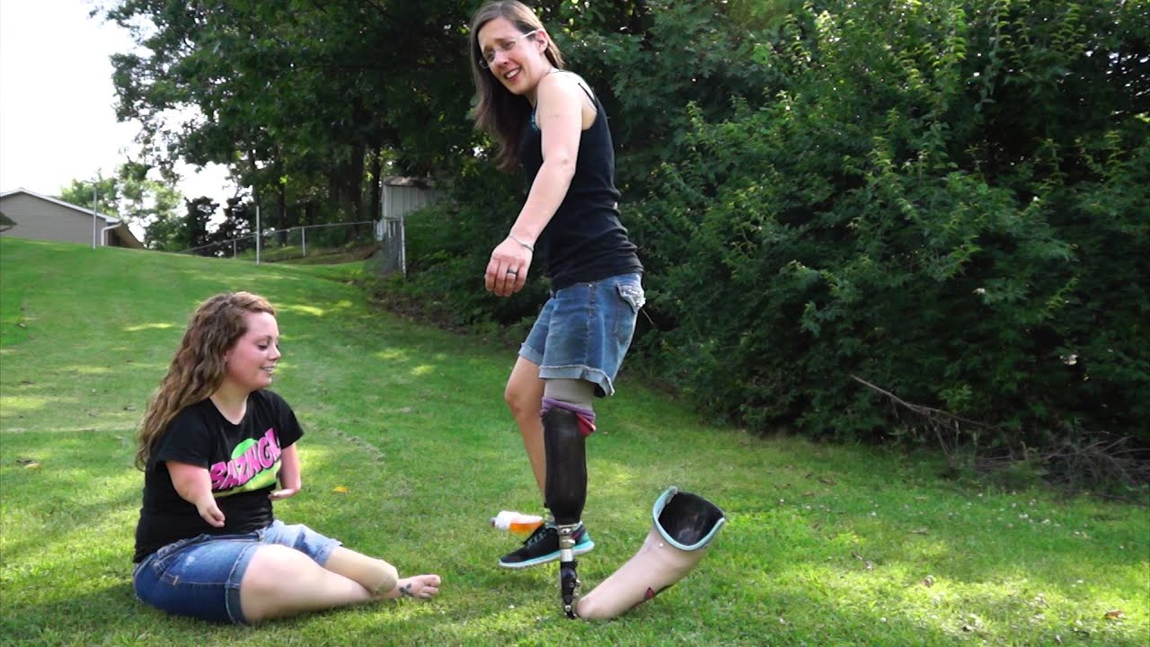 Why being an Amputee is AWESOME... Outtakes!