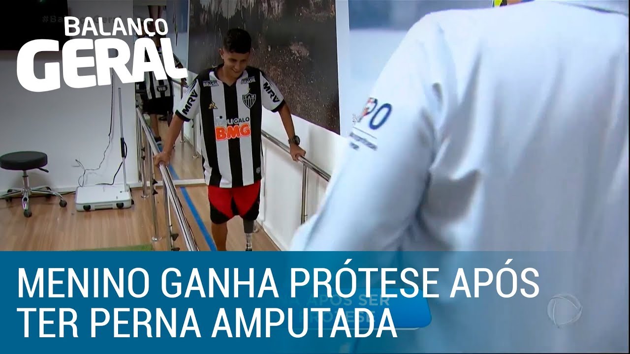 Menino ganha prótese após ter a perna amputada por cerol