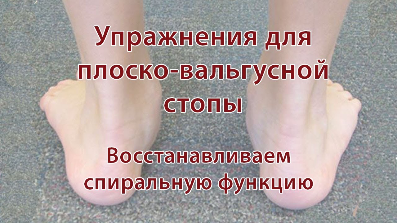 Упражнения для плоско-вальгусной стопы