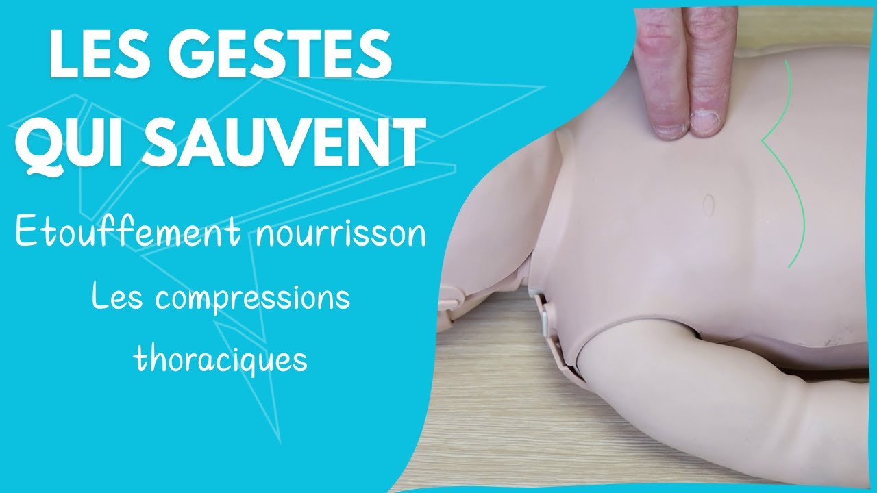 Secourisme - Étouffement - désobstructions des voies aériennes par les compression thoracique