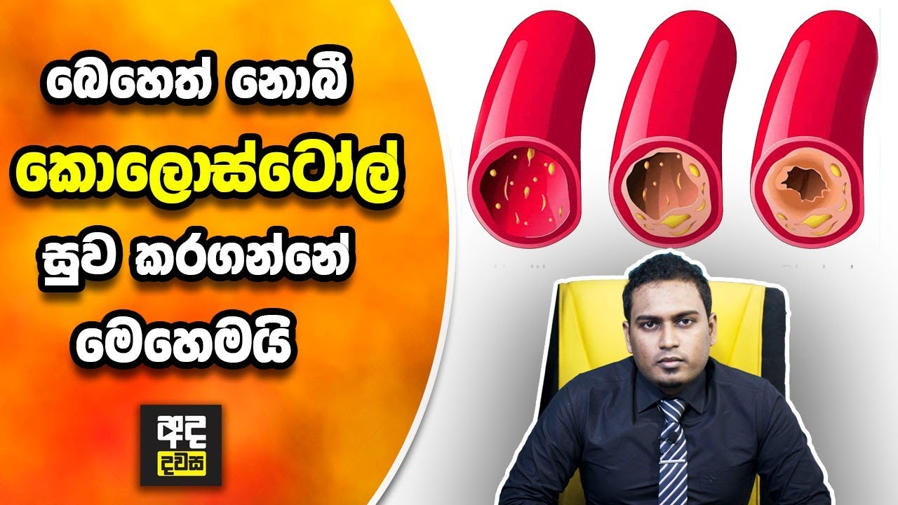 බෙහෙත් නොබී කොලොස්ටෝල් සුව කරගන්නේ මෙහෙමයි - Natural Remedies for Cholesterol