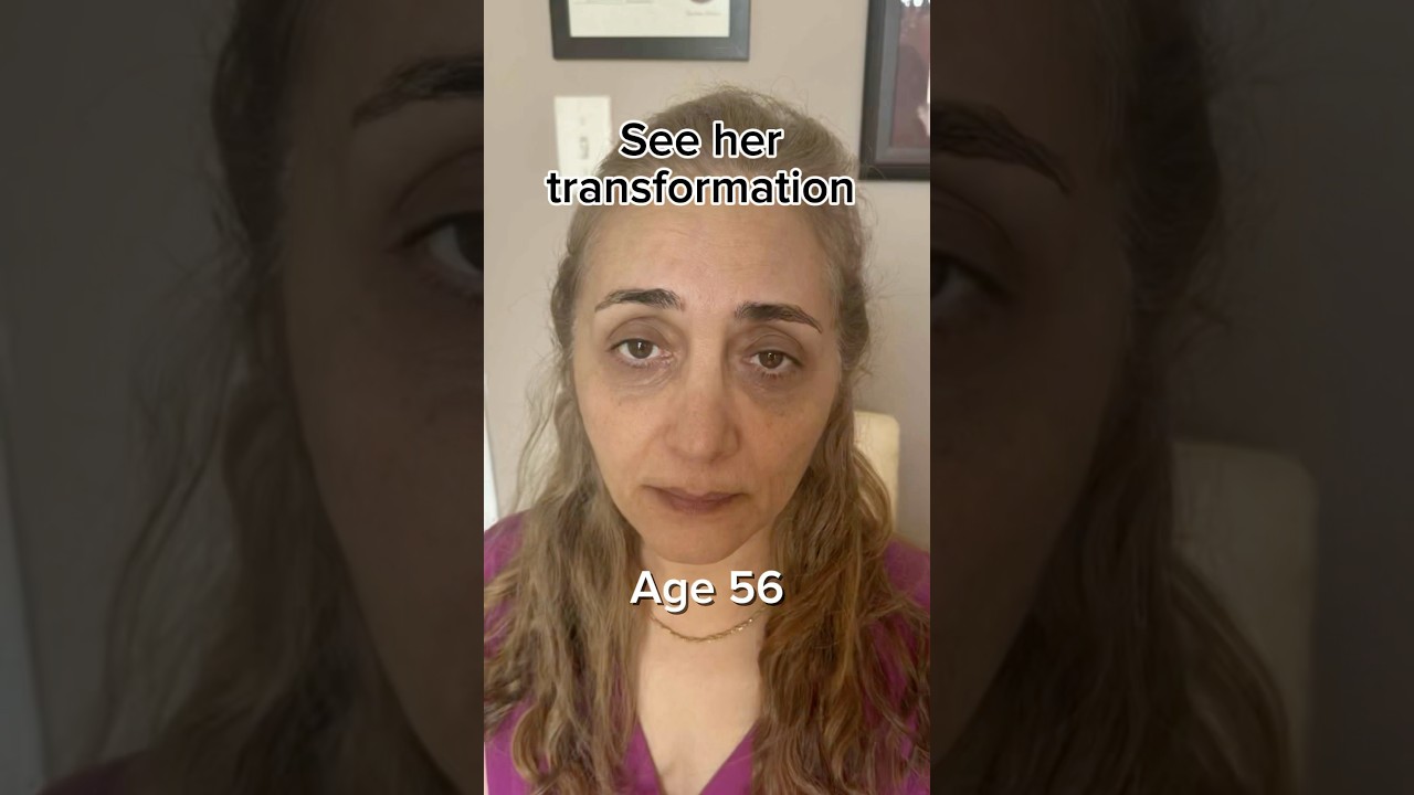 See her transformation | Face Fitness Face Yoga | Face Massage