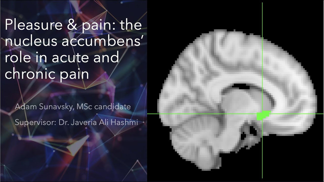 Pleasure & Pain: How the Nucleus Accumbens is Altered in Chronic Pain