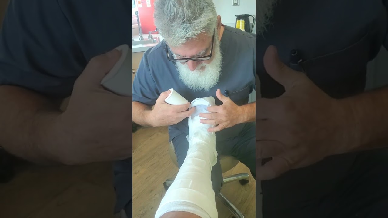 How to Make a Short Leg Cast with a Toe Plate. ( Part 1 of 2)