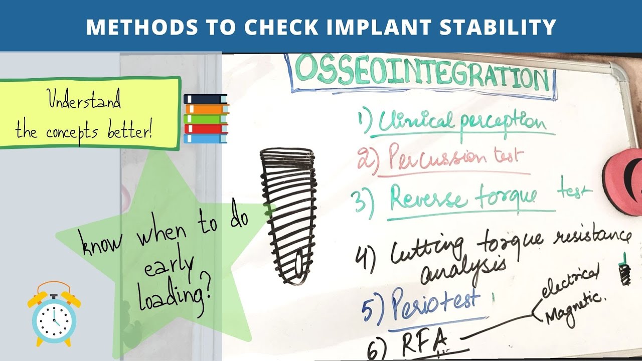 osseointegration of dental implants - final part